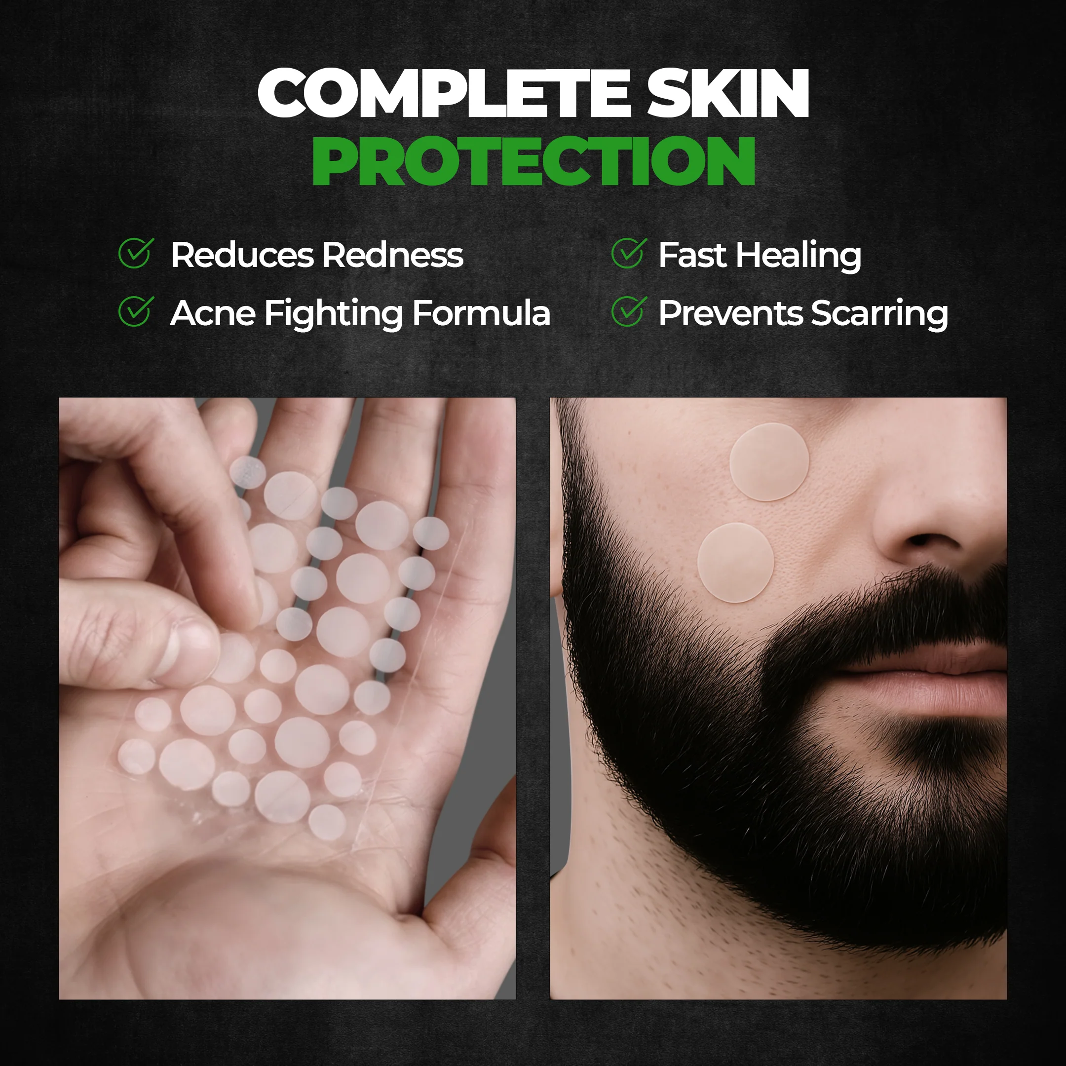 Doctor Acne Pimple Patch - Image 6